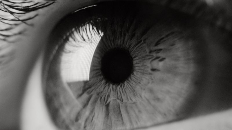 close up of an eye that is being examined at the Brisbane optometry practice of Dean Samarkovski Optometrist