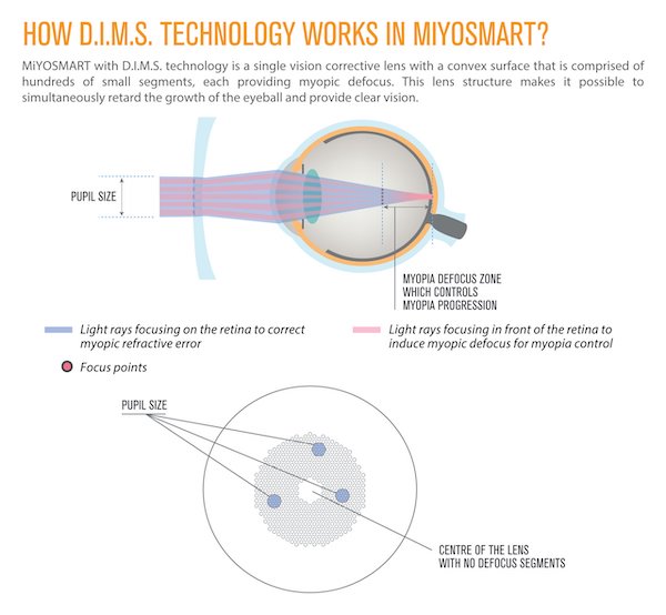 Ray tracing diagram depicting the optical properties of the Hoya MiyoSmart lenses