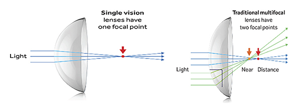 Ray tracing schematic comparing a regular contact lens and one that is used to slow the progression of myopia.